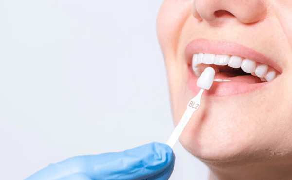 How Preventive Dentistry Shapes The Success Of A Smile Makeover