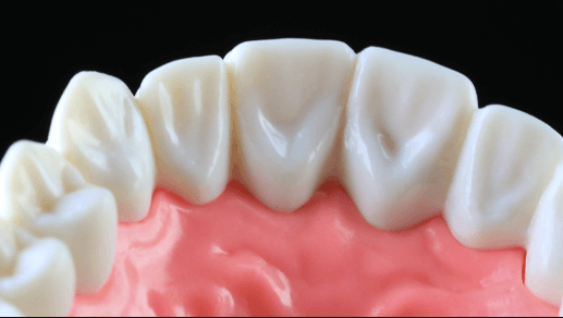 Bad Breath And Gum Disease: The Hidden Link Periodontists See Often