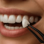 5 Ways Family Dentists Customize Cosmetic Plans For Sensitive Teeth