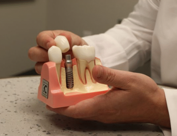 4 Reasons Periodontal Treatment Improves Implant Success
