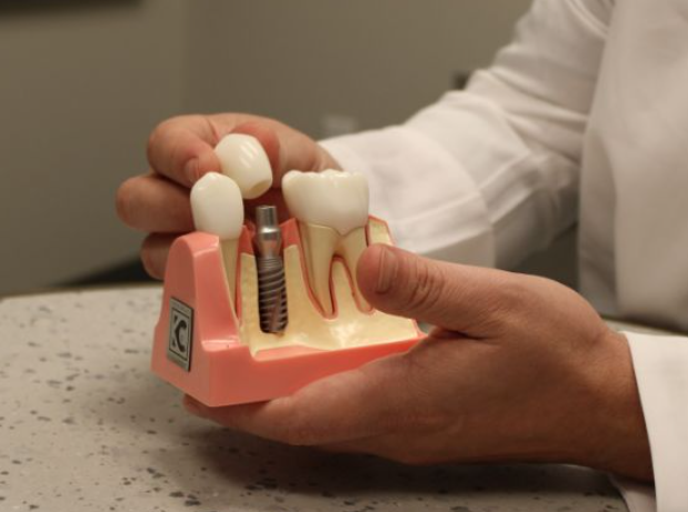 4 Reasons Periodontal Treatment Improves Implant Success