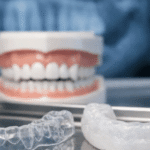 Why Retainers, Mouthguards, And Whitening Trays Should Never Be Shared