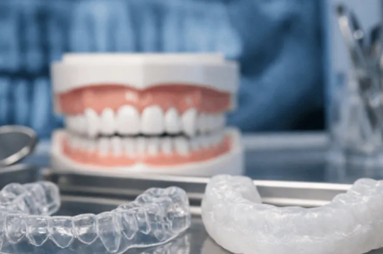 Why Retainers, Mouthguards, And Whitening Trays Should Never Be Shared